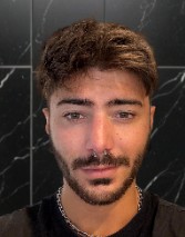 Francesco Fantini
